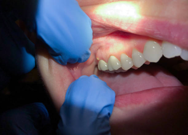 Best Emergency TMJ Treatment in Lindale, GA