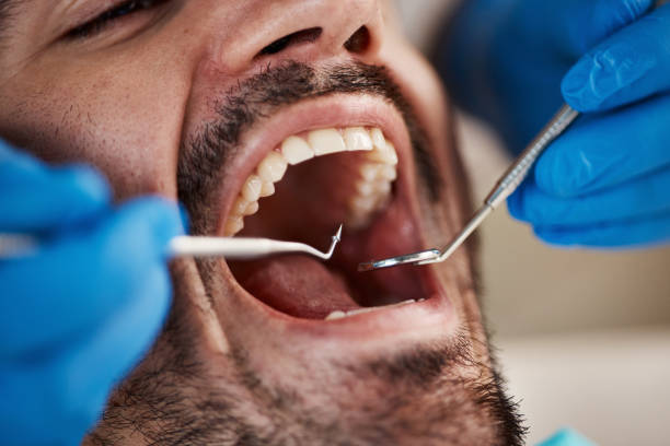 Best Emergency Treatment for Dental Infections or Abscesses in Lindale, GA