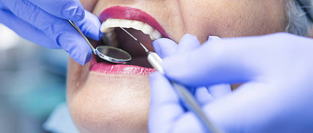 Best Emergency Dental Care for Broken or Chipped Teeth in Lindale, GA